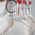 Omocisteina alta: cause, abitudini e quando misurarla